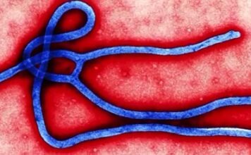 Ложная тревога в Гамбурге: вирус Эбола не обнаружен