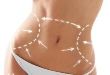 Жители Германии увлеклись операциями красоты